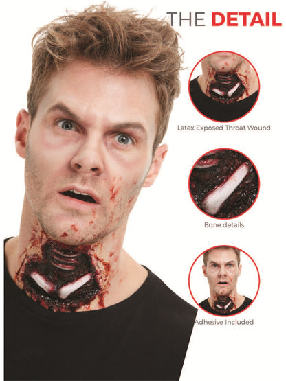 Exposed Throat FX Appliance Transfer Prosthetic Wound