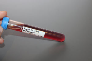 Simulated Blood in Urine Medical Specimen Tube