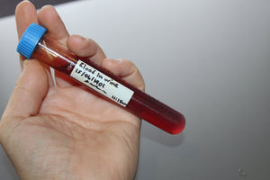 Simulated Blood in Urine Medical Specimen Tube