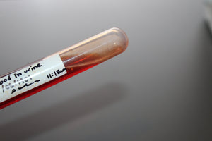 Simulated Blood in Urine Medical Specimen Tube