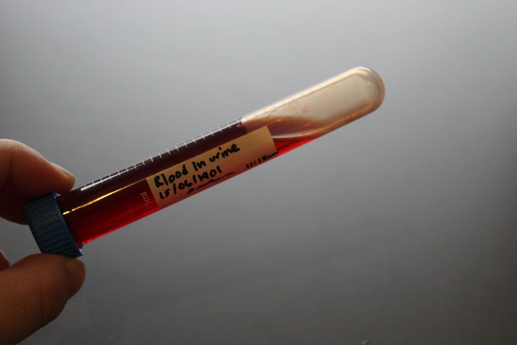 Simulated Blood in Urine Medical Specimen Tube