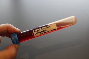 Simulated Blood in Urine Medical Specimen Tube