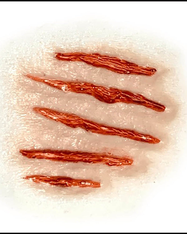 Attacked FX Appliance Transfer Prosthetic Wound