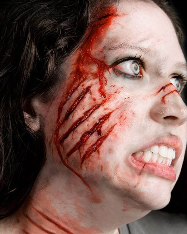 Attacked FX Appliance Transfer Prosthetic Wound