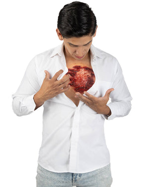 Open Chest FX Appliance Transfer Prosthetic Wound