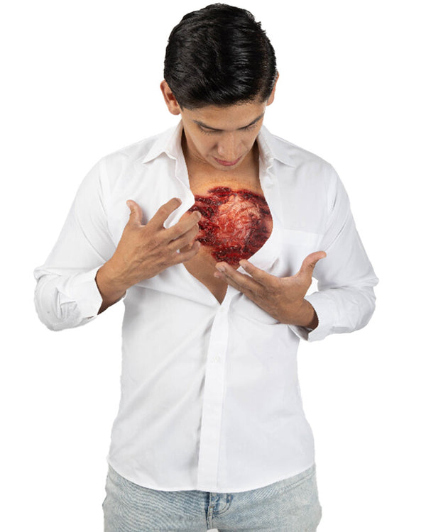 Open Chest FX Appliance Transfer Prosthetic Wound