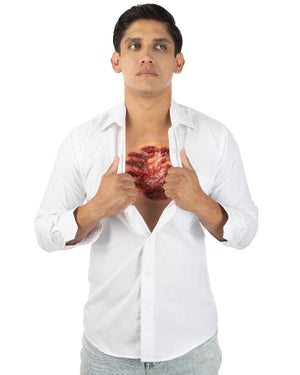 Open Chest FX Appliance Transfer Prosthetic Wound