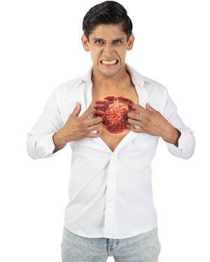 Open Chest FX Appliance Transfer Prosthetic Wound