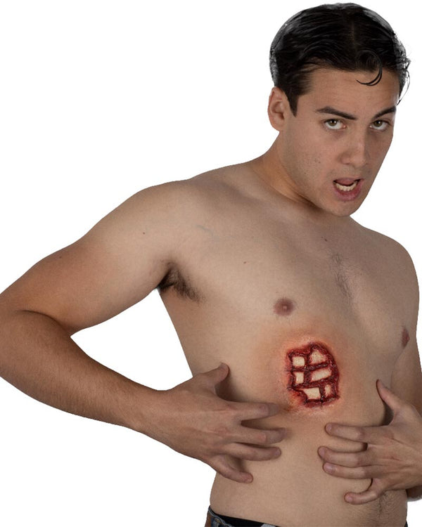 Rib Injury FX Appliance Transfer Prosthetic Wound