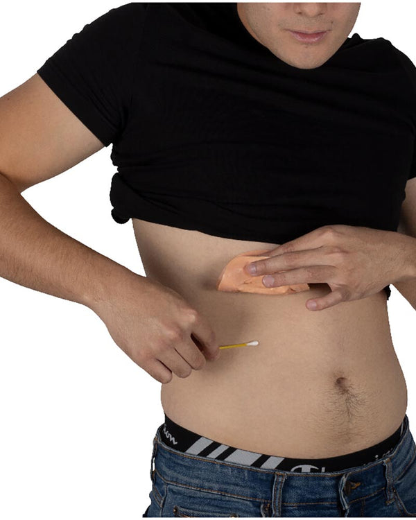 Rib Injury FX Appliance Transfer Prosthetic Wound