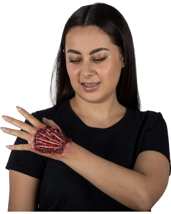 Tendon Injury Luxury FX Appliance Transfer Prosthetic Wound