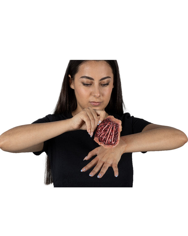 Tendon Injury Luxury FX Appliance Transfer Prosthetic Wound