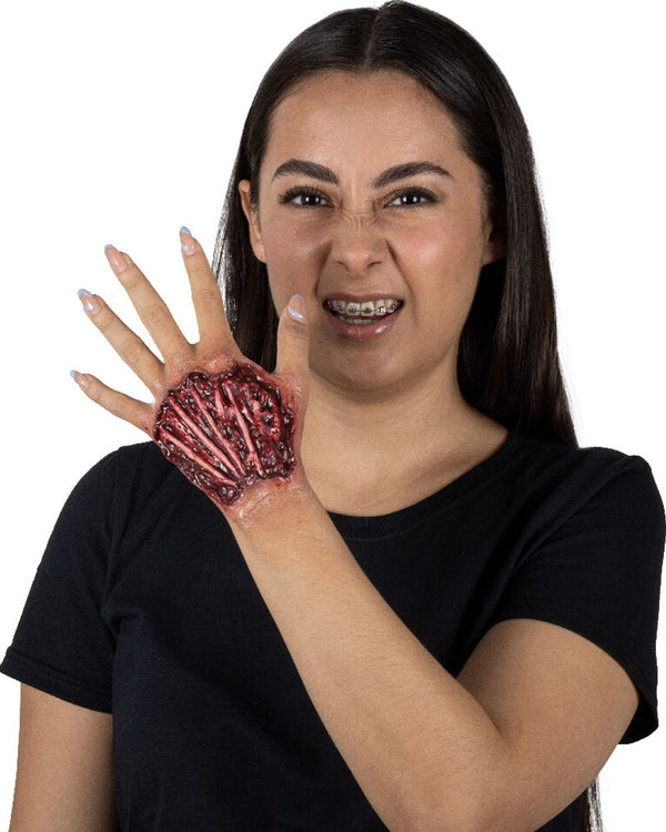 Tendon Injury Luxury FX Appliance Transfer Prosthetic Wound