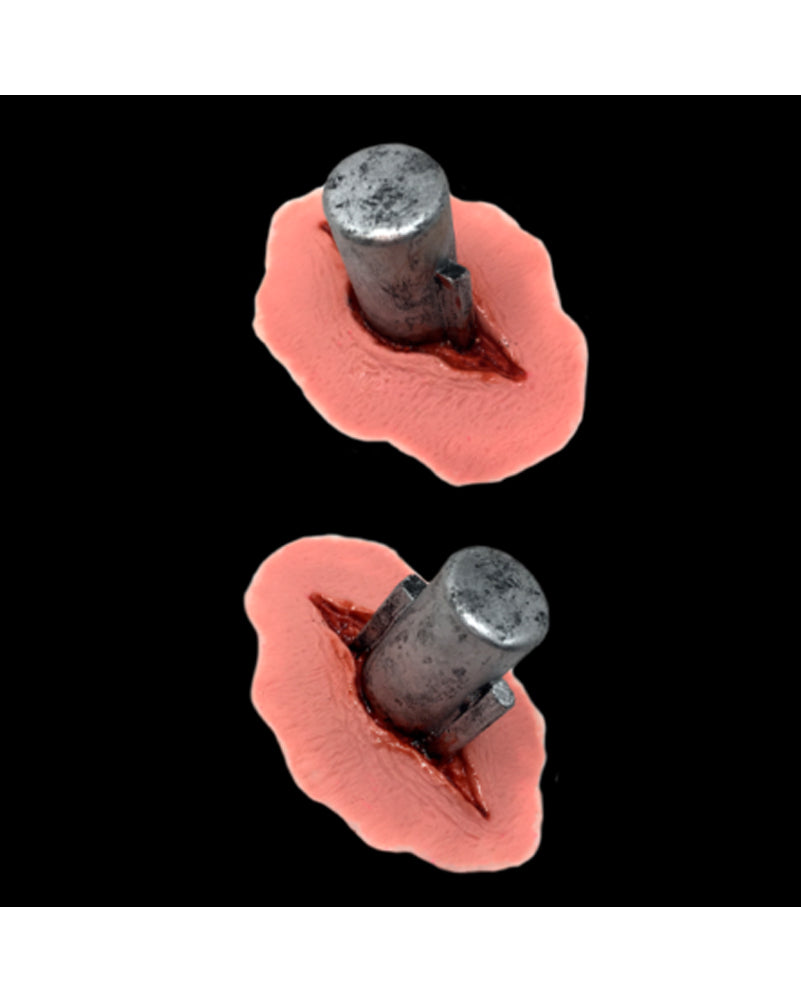 Black Label Bolts FX Appliance Transfer Prosthetic