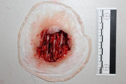 Exposed Hand Ligaments Prosthetic