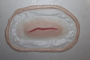 Small Thin Scar Wound Prosthetic
