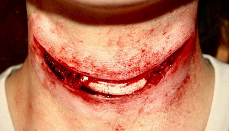 Exposed Slit Throat Prosthetic