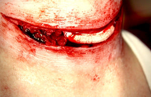 Exposed Slit Throat Prosthetic