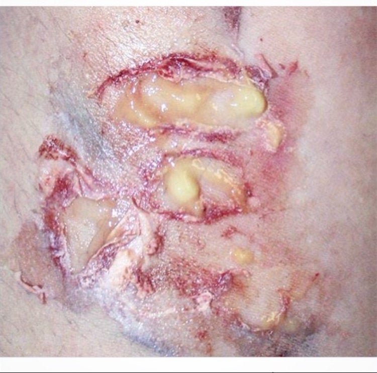 Pus Makeup Effect Gel