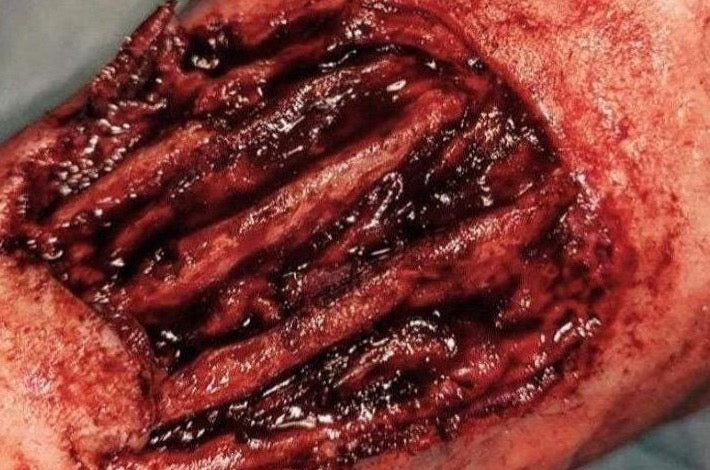 Exposed Hand Ligaments Prosthetic