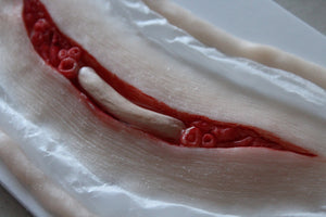 Exposed Slit Throat Prosthetic