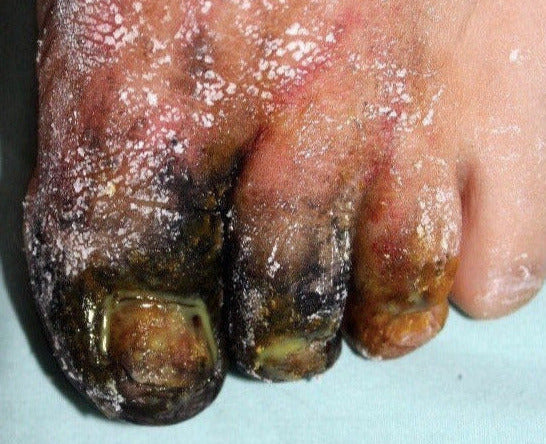 Pus Makeup Effect Gel