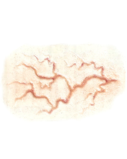 Large Veins FX Appliance Transfer Prosthetic