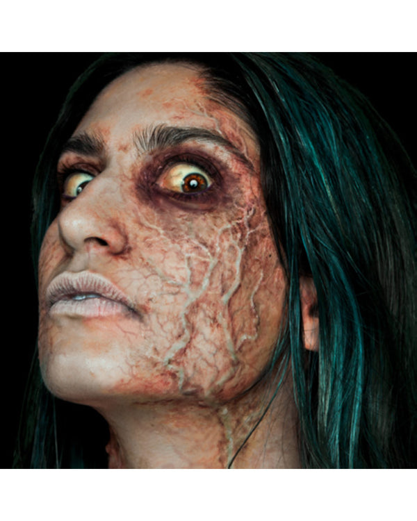 Large Veins FX Appliance Transfer Prosthetic