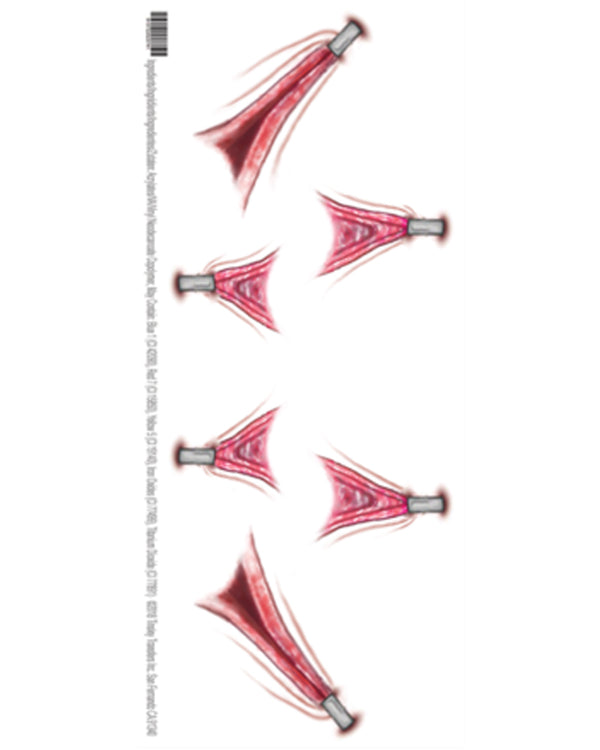 Stretched Skin FX Trauma Tattoo